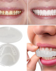 ClearSmile – Dentadura EasyClick para una sonrisa radiante