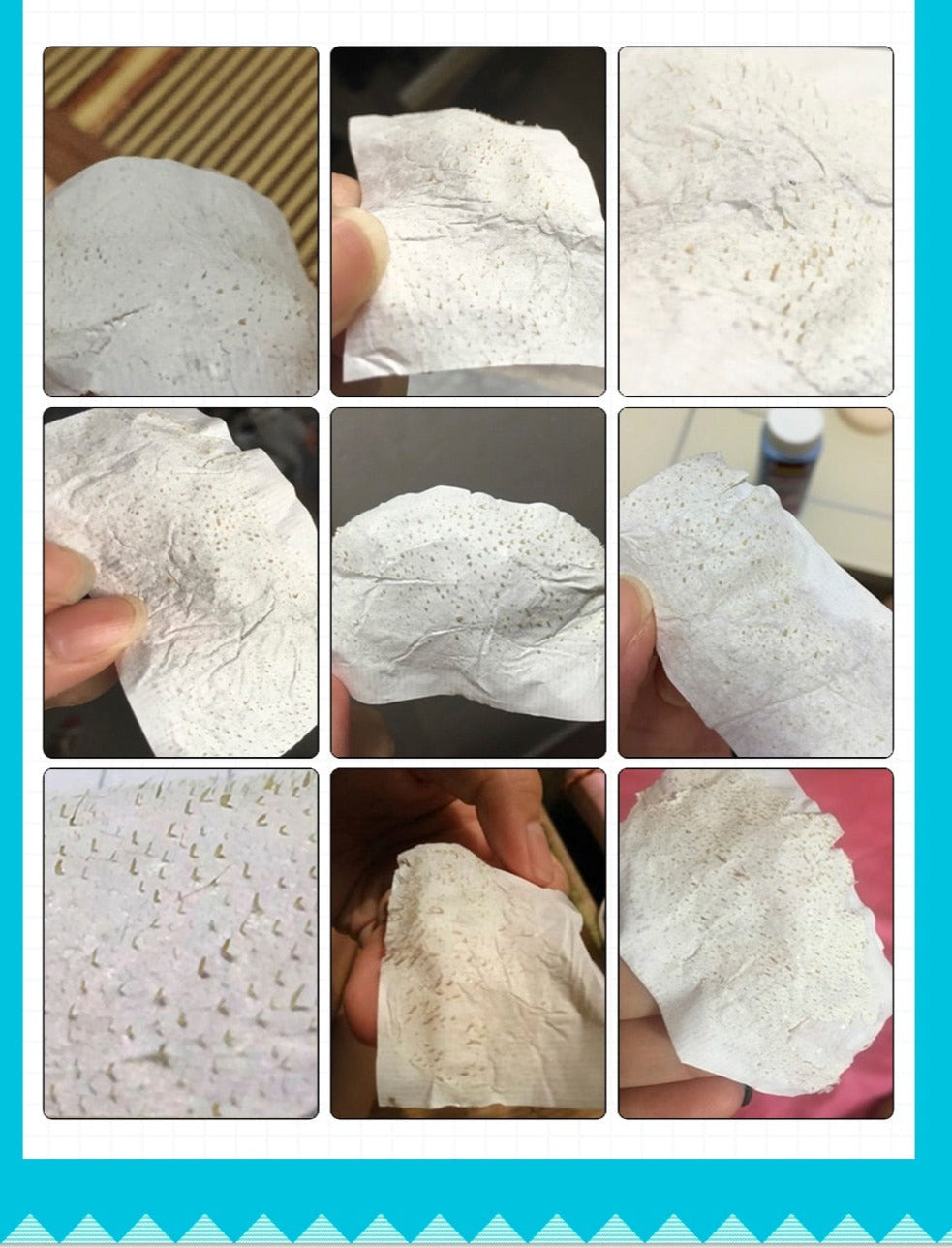 Blackhead Removal Strips