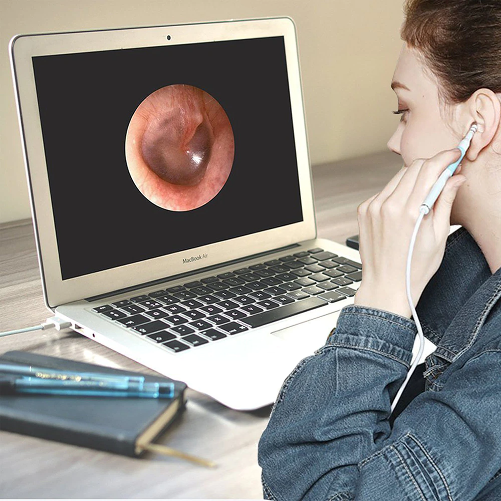 Ear Camerar Ear Cleaner | 3-in-1 Ear Cleaning Camera – Style Maha