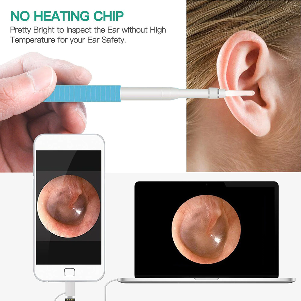 Ear Camerar Ear Cleaner | 3-in-1 Ear Cleaning Camera – Style Maha
